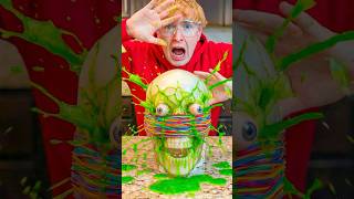 10,000 Rubber Bands vs Human Head!