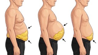 Stubborn Belly Fat & Insulin Resistance – Why You’re Not Losing Weight Even With Normal Blood Sugar