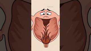 ​El misterio del tabique uterino 🤰⚠️#shortvideo #2danimation #animacion #cartoon #funny