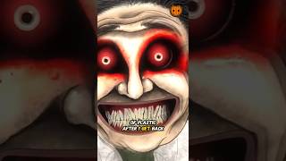 SCARY BBL DOCTOR 😱 #shorts