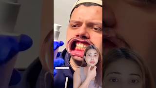 clean teeth #hype #trending #short #shorts #shortvideo #song #viralvideo #viral #video #makeup